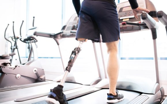 Amputacja kończyny dolnej a sport i rekreacja | WZSO 