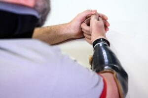 Protezy kończyn górnych Protezy ręki i pokrycia kosmetyczne – przegląd rozwiązań dostępnych na rynku | WZSO