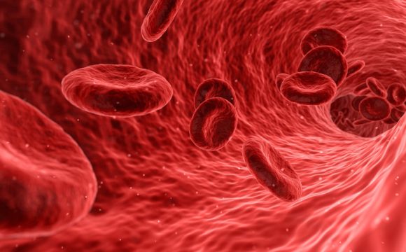 Miażdżyca – najważniejsze informacje